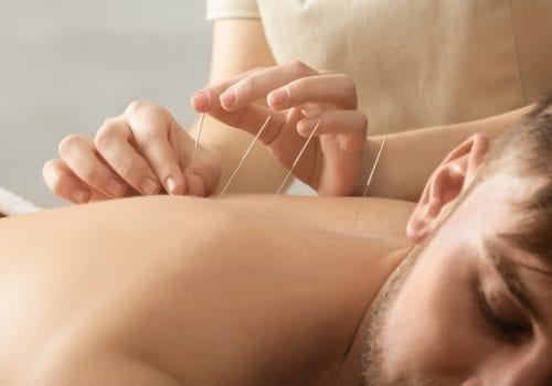 How Acupuncture Can Relieve Stress